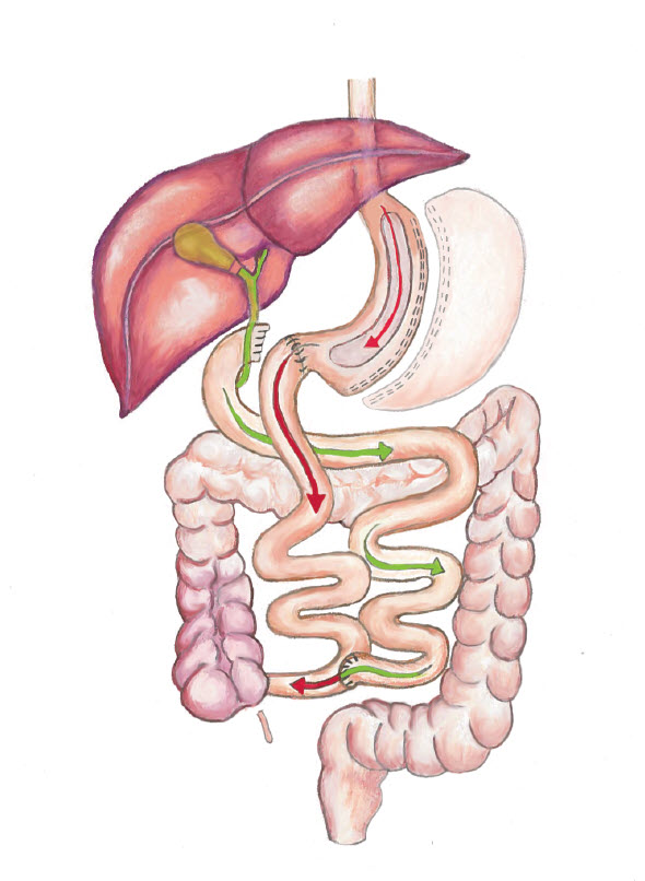 Weight loss surgery options Colorado UCHealth