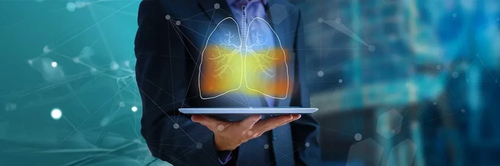 UCHealth catching lung cancer earlier. Virtual drawing of lungs.