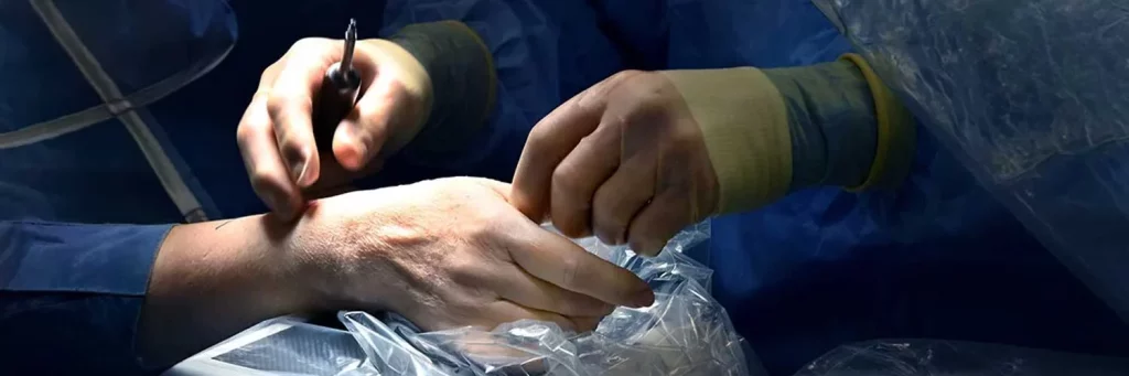 UCHealth thumb surgery being performed in operating room