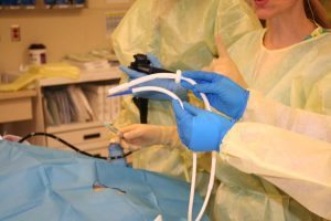 Sullivan shows the tube inserted in the patients stomach as part of the AspireAssist procedure.