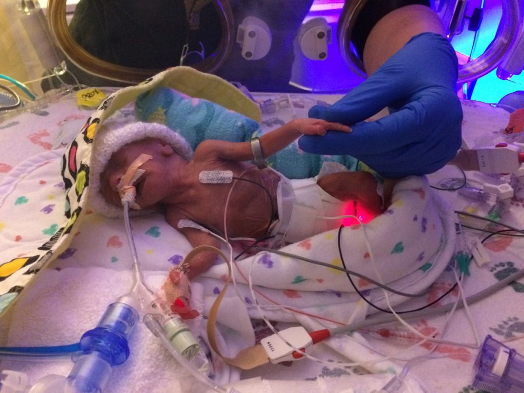 Finn in the NICU