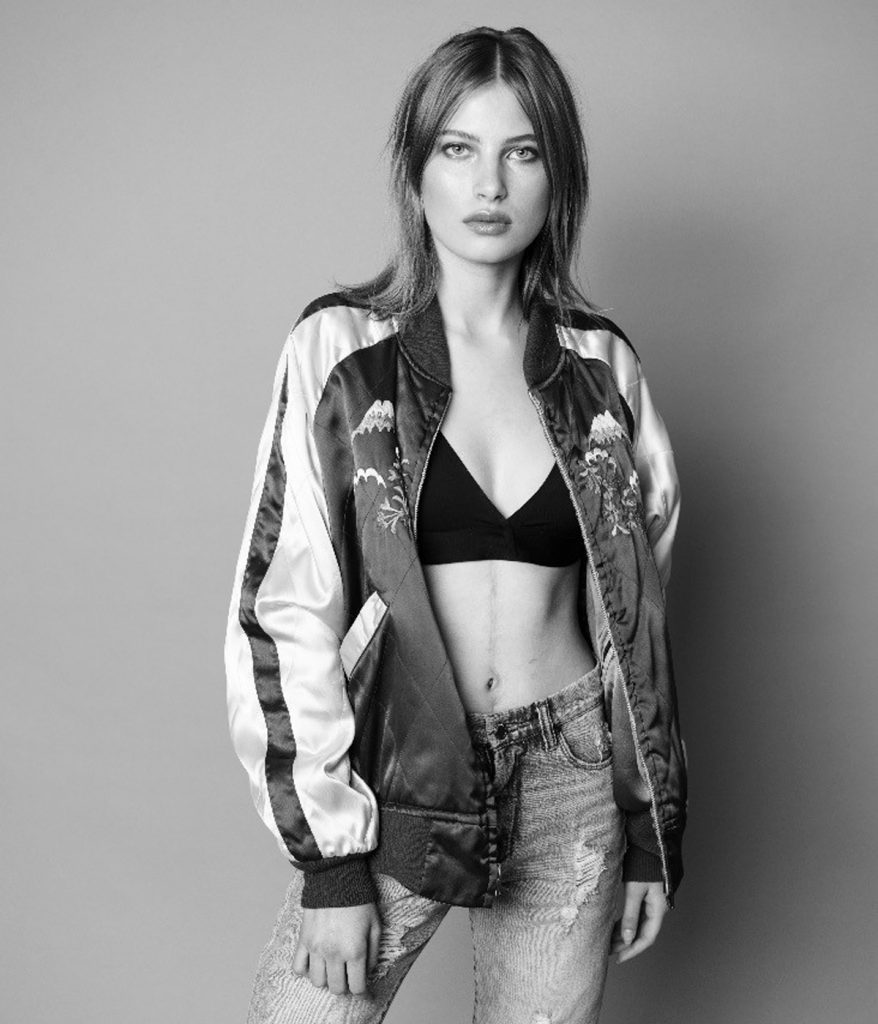 Peyton poses in a modeling shot that shows her scar faintly on her belly.
