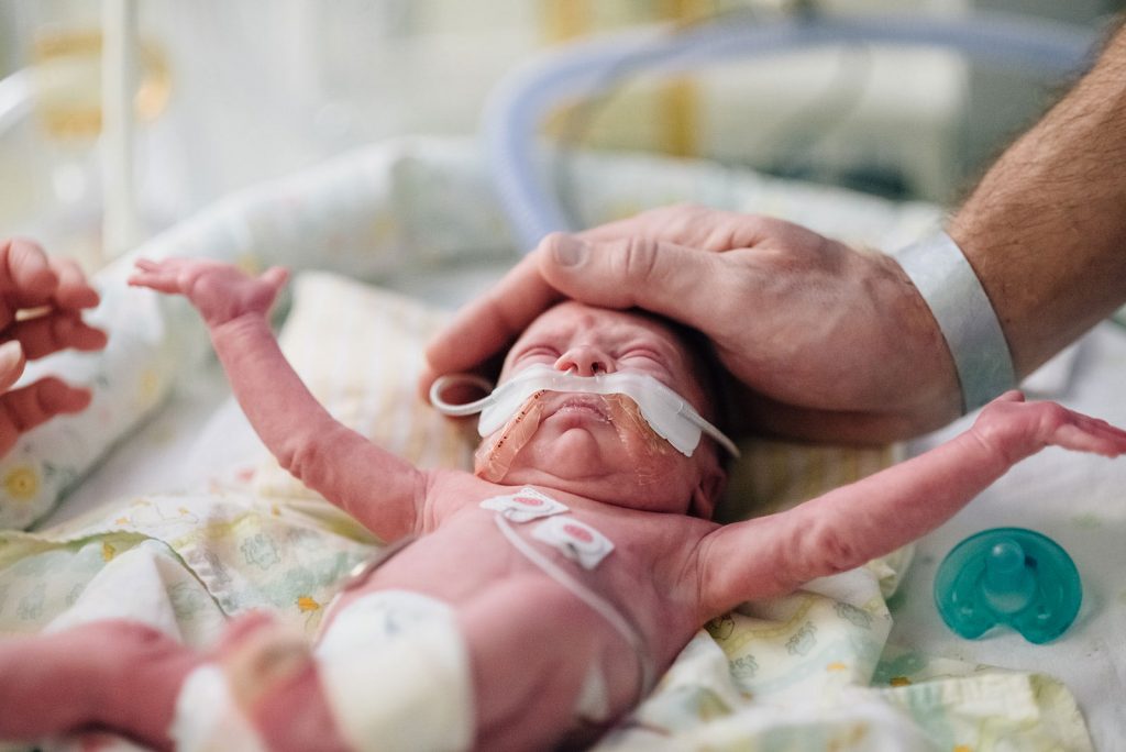 A preemie baby, Lincoln Gray Grewar, holds his arms out.