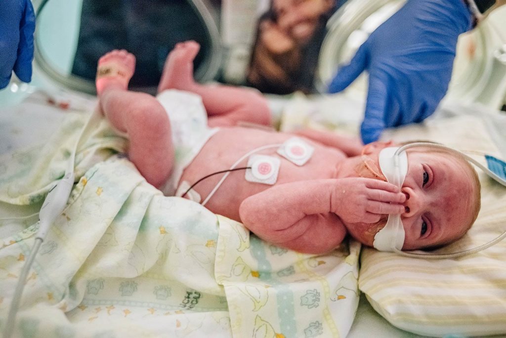 Photo of preemie, Lincoln Grewar