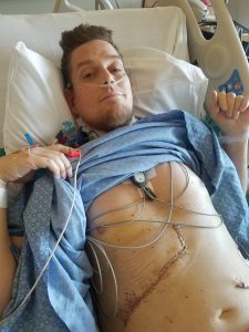 This is a photo of George Gess one day after his liver transplant.