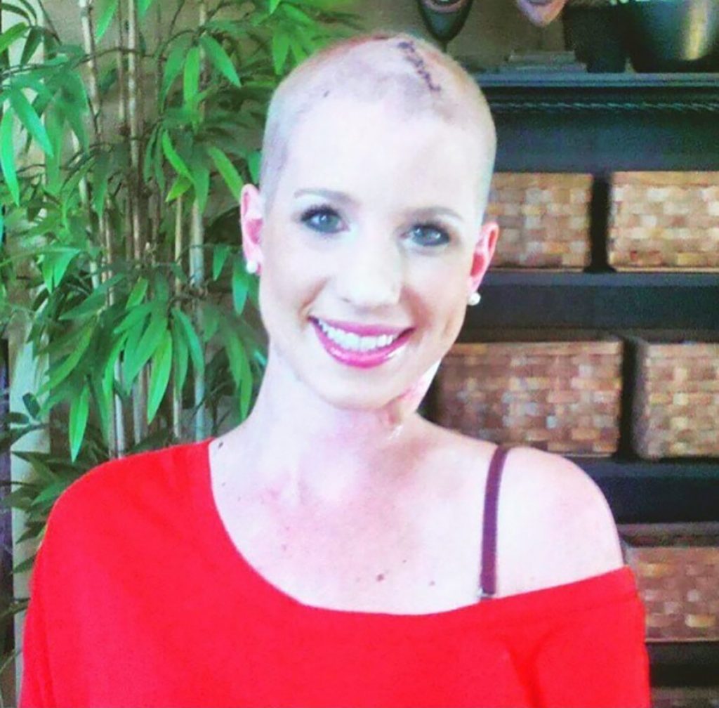Even with her head shaven and big scar on the top of her head, Lauren has smiled as she has coped with metastatic melanoma.