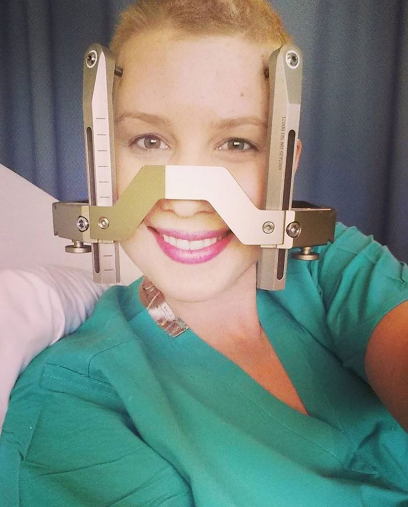Lauren had to have a cage attached to her head when she received radiation treatments to burn away tumors in her brain.
