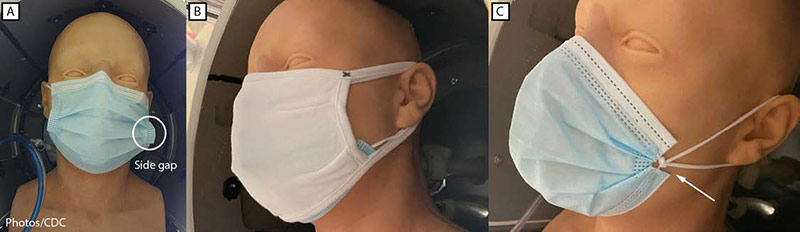 Masks the CDC researchers tested, including A, unknotted medical procedure mask; B, double mask (cloth mask covering medical procedure mask); and C, knotted/tucked medical procedure mask. Photo courtesy of CDC.