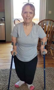 Kotzian was born with achondroplasia, commonly called dwarfism. Here she walks with supports after her spine surgery.
