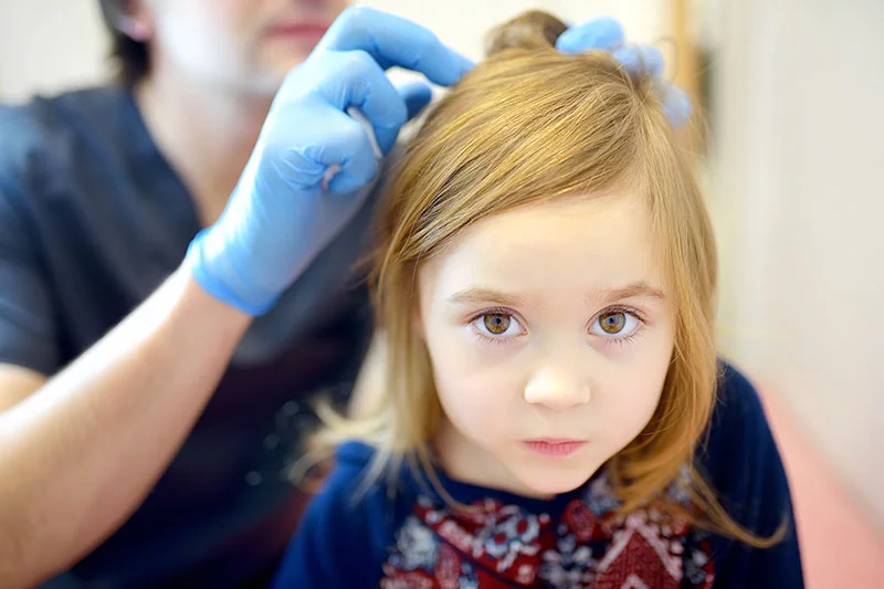 Lice don’t hop or fly. They spread through shared items like brushes and hats. Getting rid of lice requires a medicated shampoo, careful combing and follow-up checks. Photo: Getty Images.