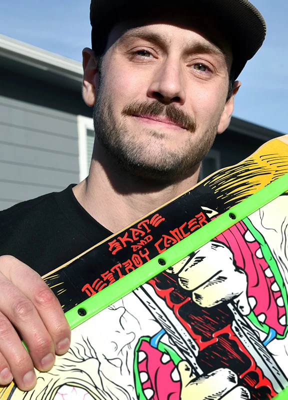 Kiesel added a “Skate and Destroy Cancer” sticker to his skateboard after he was diagnosed with Stage 4 pancreatic cancer two years ago. Photo by Sonya Doctorian, UCHealth.