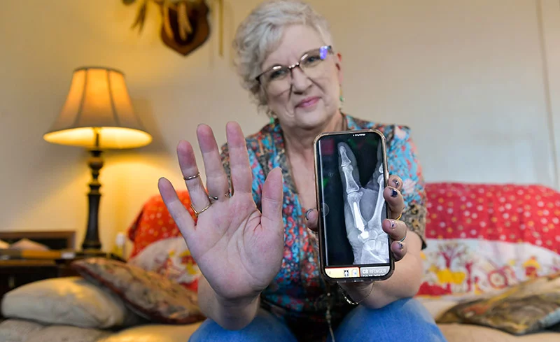 Traceyrené recovered quickly after her surgery and experienced much less pain than before her surgery. Here, she shows how well her right thumb and hand have healed alongside an X-ray image that shows her new Touch CMC 1 implant. Photo by Cyrus McCrimmon for UCHealth.