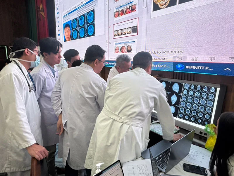 A group of surgeons reviews a pediatric craniofacial case involving a child with a misshapen skull during a session at Viet Duc University Hospital in Hanoi. Dr. Phuong Nguyen and his team from Colorado recently traveled to Hanoi, Vietnam to teach advanced surgical techniques to local surgeons. Photo courtesy of Dr. Mark Greyson.