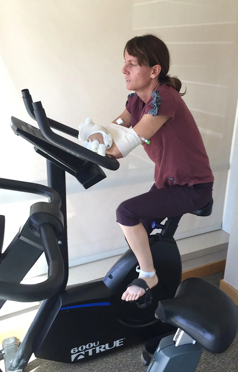 Melissa worked hard doing extensive rehabiliation following her accident. Photo by Lisa Foster, courtesy of Melissa Strong.
