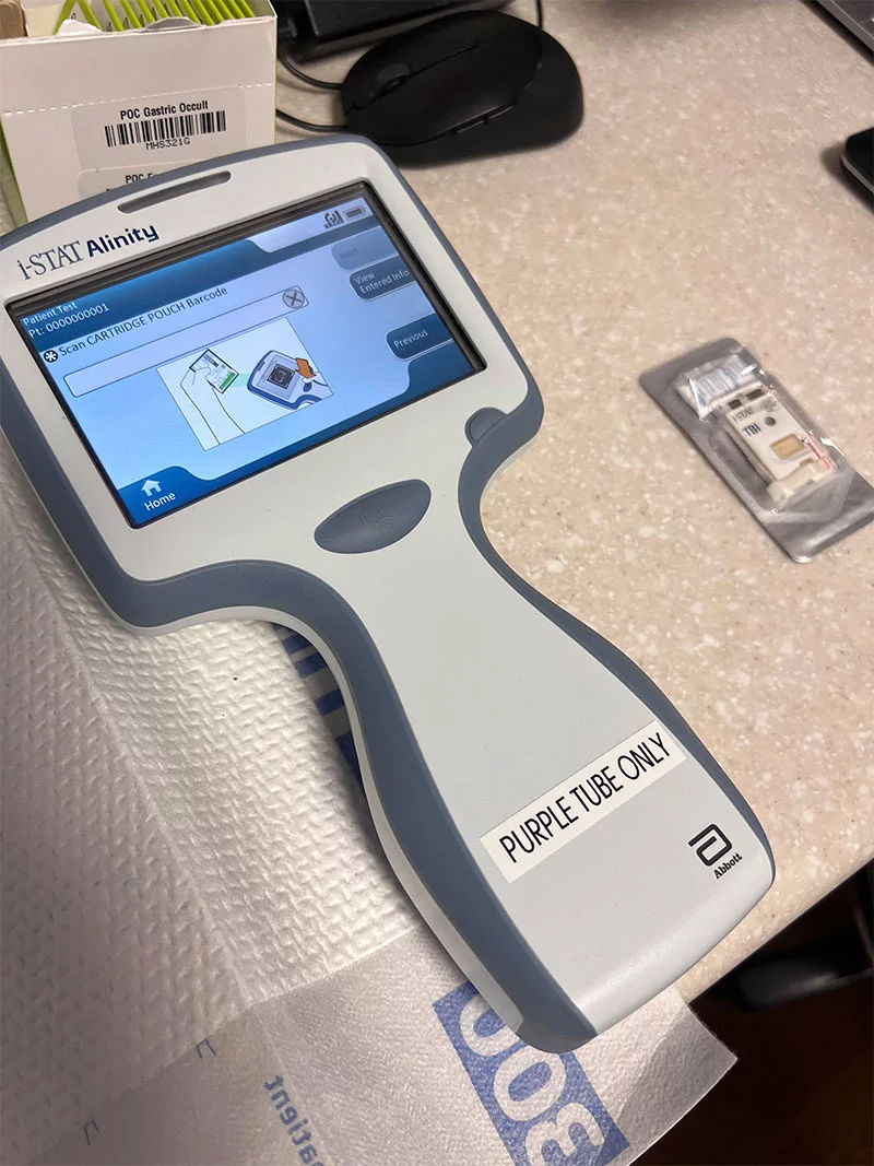 the i-STAT Alinity blood test device that tests for brain injury biomarkers. Doctors are using a new handheld device and single-use cartridge to check for biomarkers that appear in the bloodstream when a patient has bleeding around the brain. The device uses a few drops of a patient's blood and shows results on the screen in about 15 minutes.